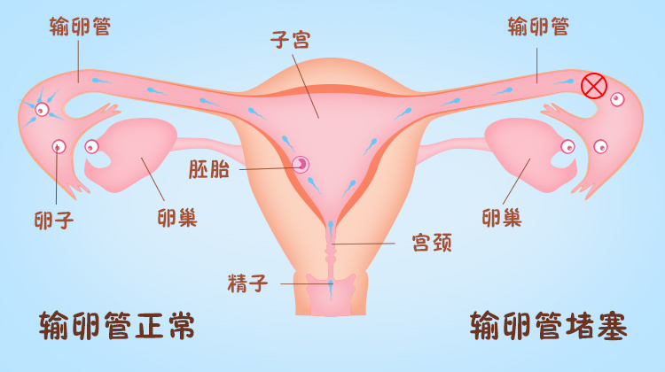 昆明送子鸟医院