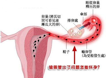 昆明送子鸟医院