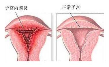 昆明送子鸟医院